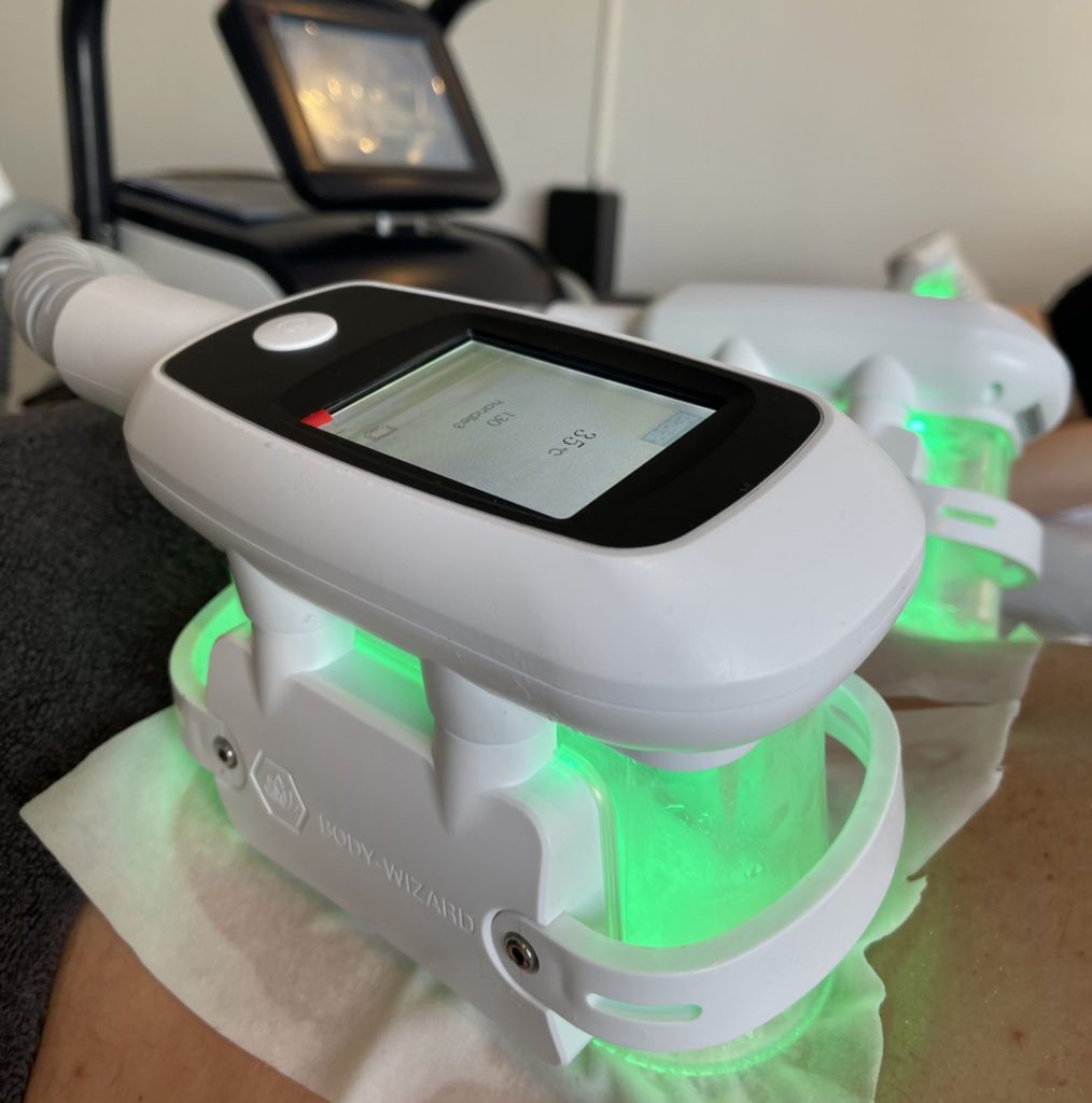 Fat Freezing Brabant - Veilig vet bevriezen met Cryolipolyse