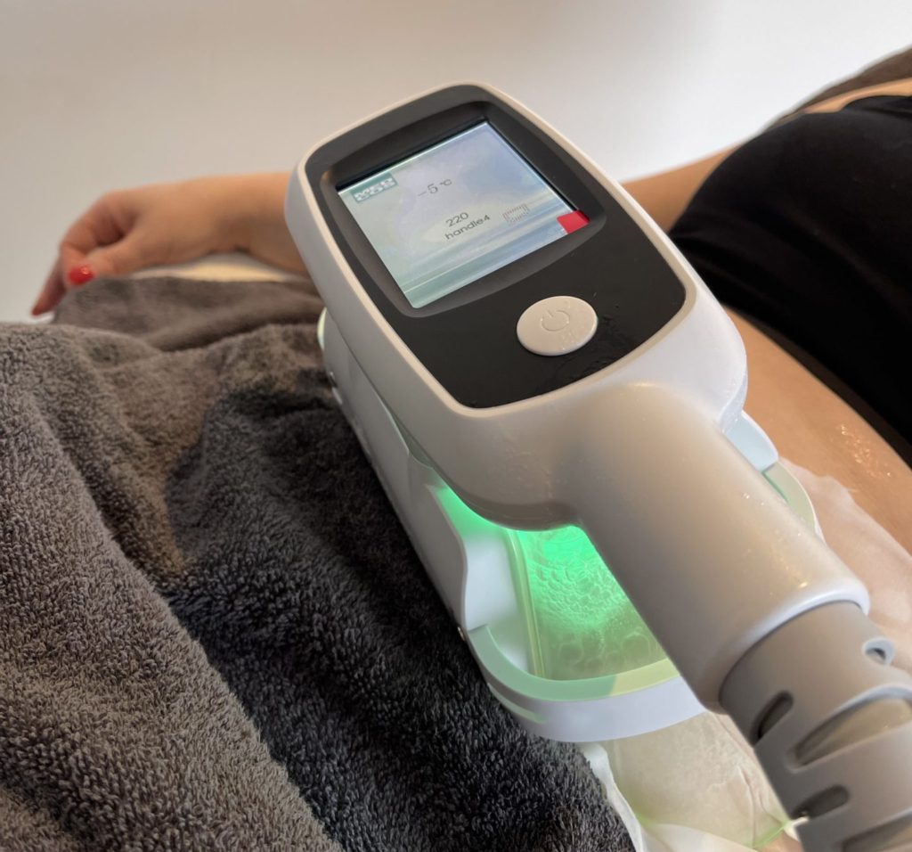 Fat Freezing Brabant - Veilig vet bevriezen met Cryolipolyse